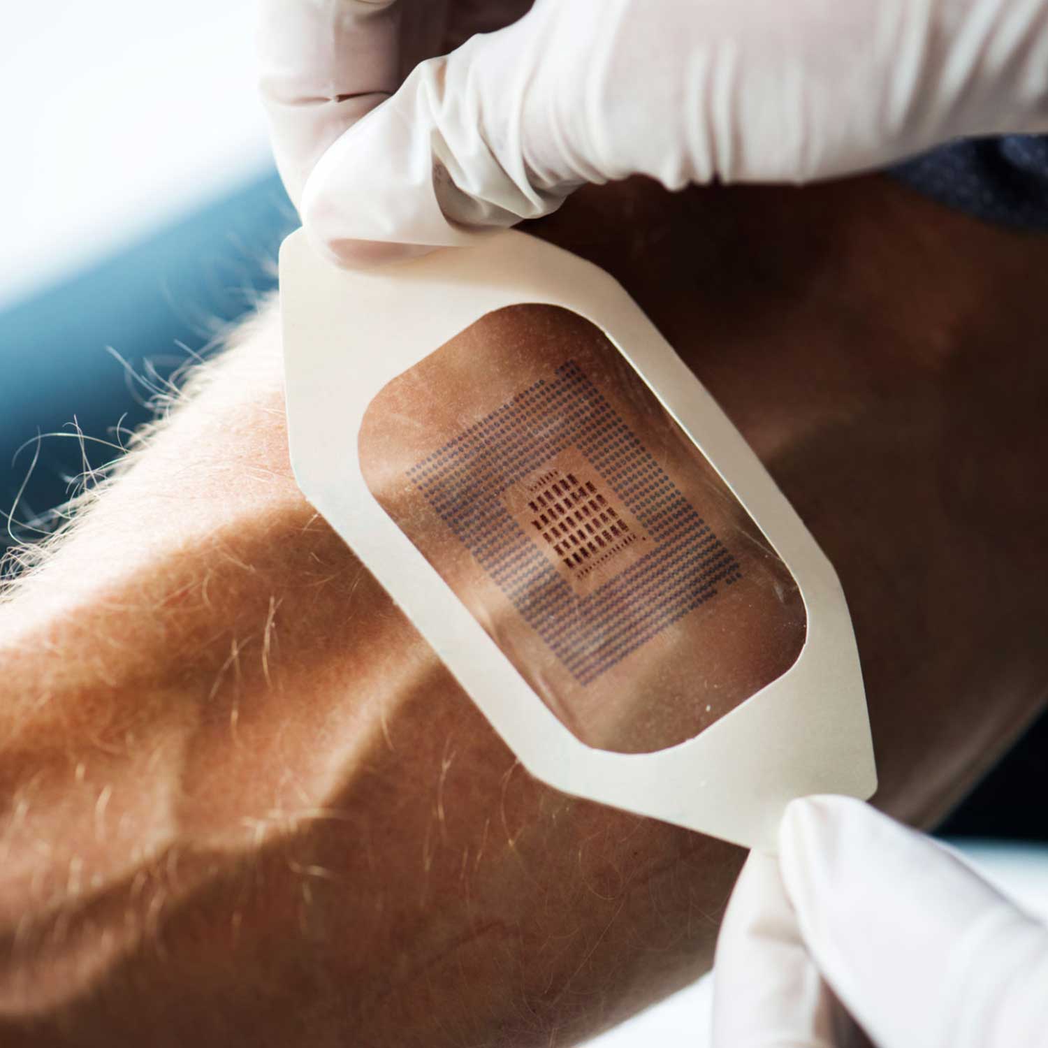 biosensors2